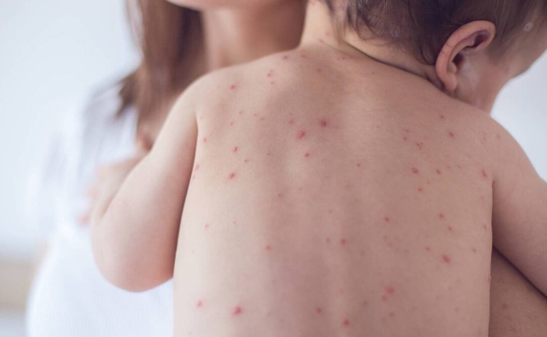 Foto: Archivo / EL UNIVERSAL