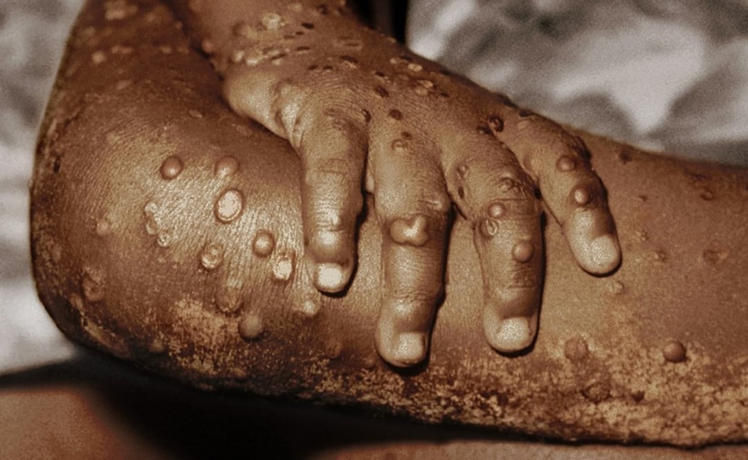 Foto: Science Photo Library