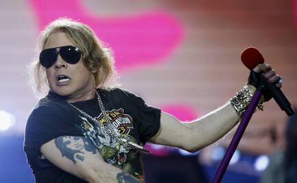 ¿Qué les pasó en el rostro a Axl Rose y Mickey Rourke? 