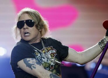 ¿Qué les pasó en el rostro a Axl Rose y Mickey Rourke?