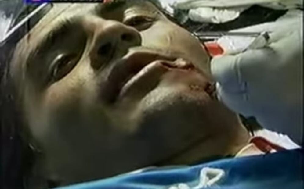 Las peores heridas por arteras entradas en el futbol