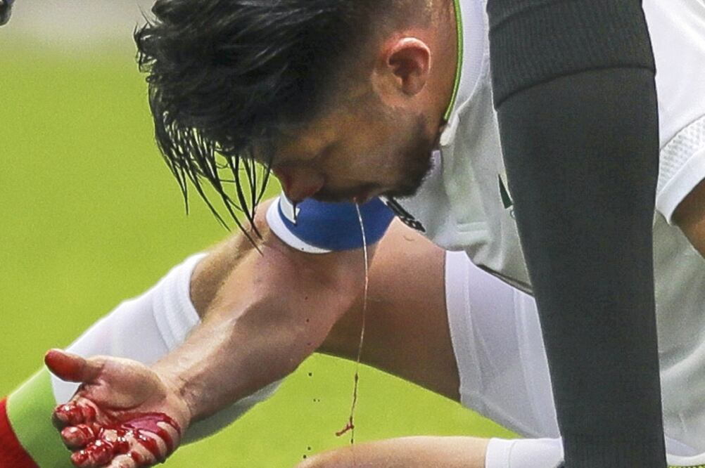 La lesión de Oribe Peralta abre la puerta a Silvio Romero (ADRIANA SPACA. IMAGO7)