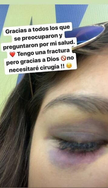 Confirman lesión de Jana Gutiérrez, jugadora de América femenil