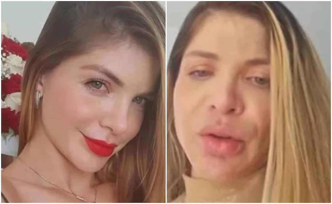 Angélica Jaramillo antes y después, tras confesar que tiene un problema de adicción a las drogas.