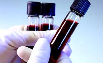 Análisis revela los virus que han afectado a una persona