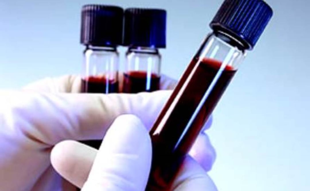 Análisis revela los virus que han afectado a una persona