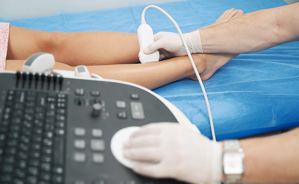 Venas varicosas: causas, síntomas y tratamientos efectivos