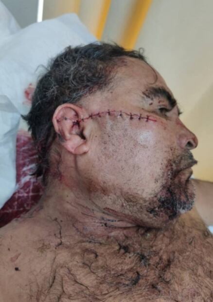 Enfrentamiento por predio en Chiapas deja 8 personas heridas y 3 detenidos