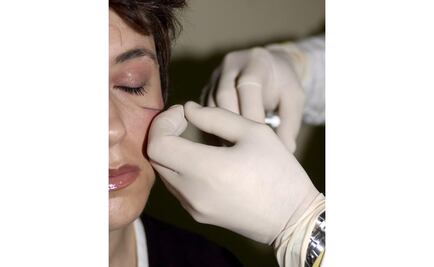 Suspenden 8 clínicas para el control de peso en CDMX