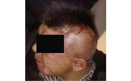 A proceso, presunto asaltante de pizzería en Iztapalapa