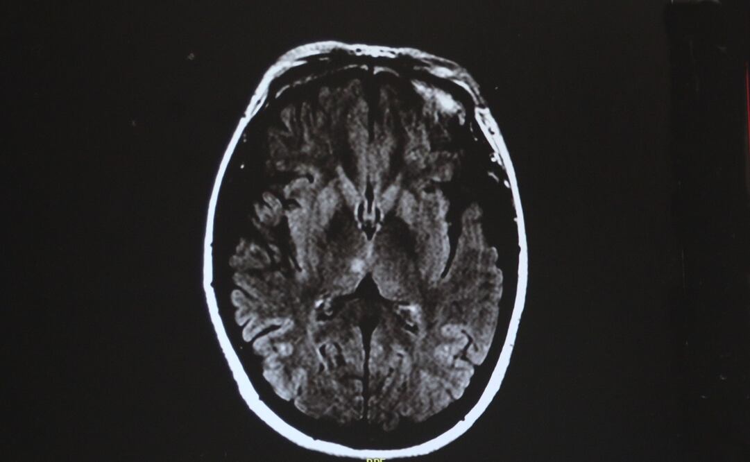 Imagen genérica de una tomografía. Foto: Archivo El Universal