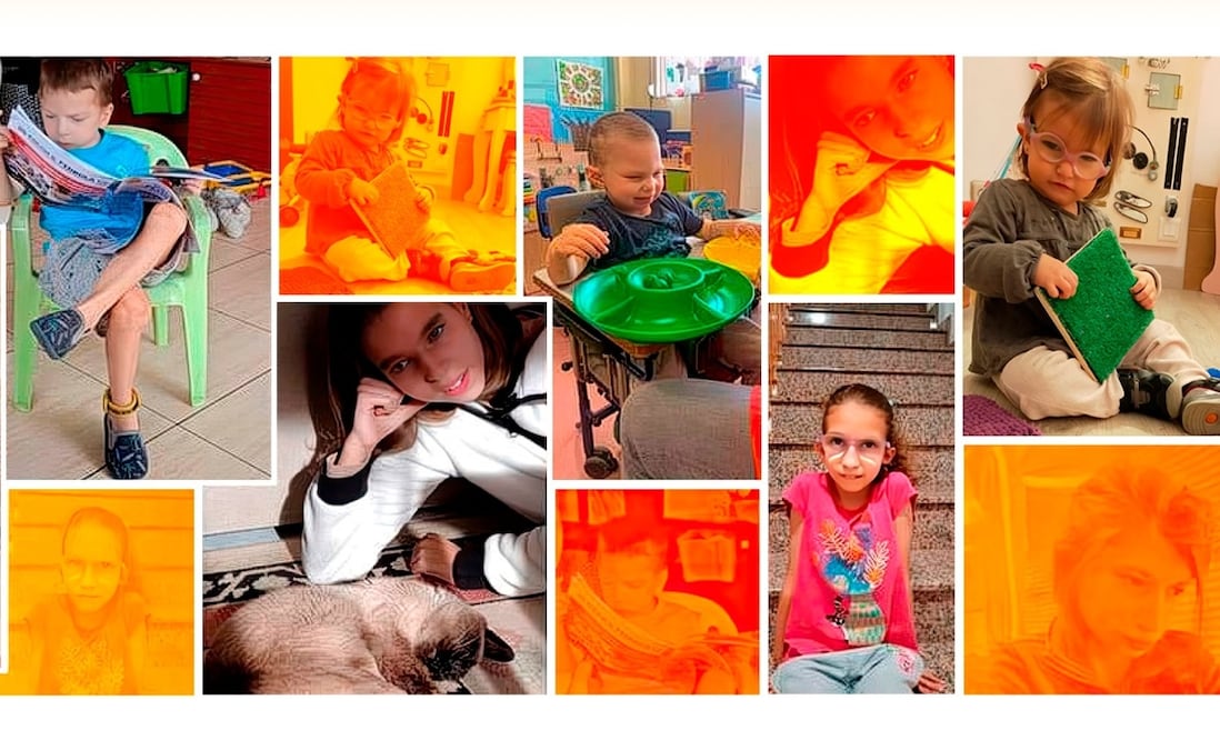 ¿Qué es el Síndrome DYRK1A?; conoce sus principales síntomas, Fuente: Asociación española de síndrome de DYRK1A