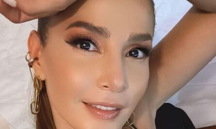 Carmen Villalobos reveló que tipo de tratamiento utiliza para olvidarse de la celulitis y estrías en su piel