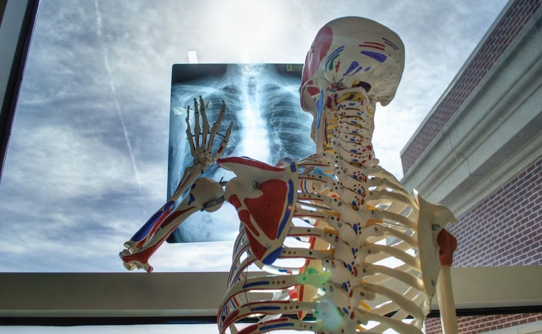 Rayos X. Fuente: Pixabay