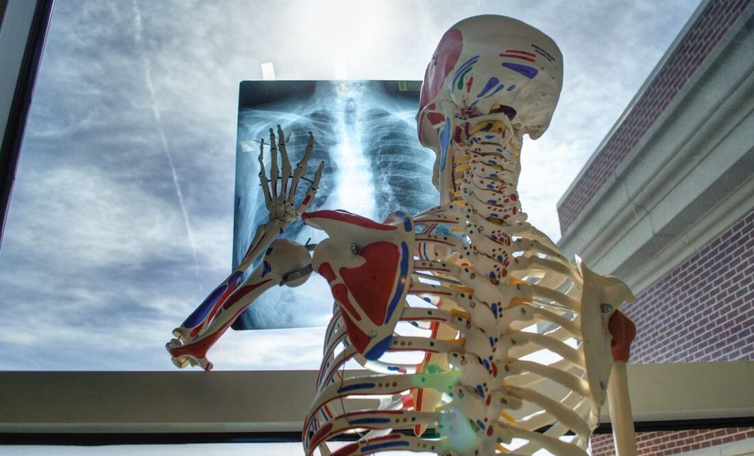 Rayos X. Fuente: Pixabay