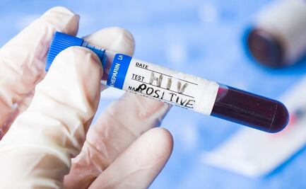 Forma potencial de erradicar la infección por VIH es identificada por expertos