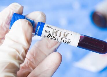 Forma potencial de erradicar la infección por VIH es identificada por expertos