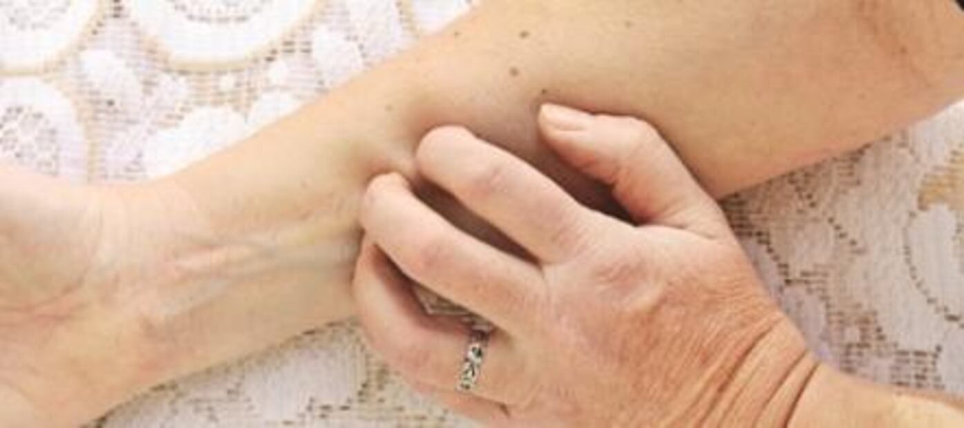 Identifican compuestos para calmar el dolor y el prurito