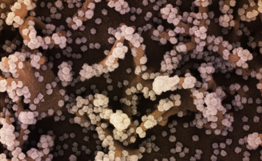 El coronavirus pone el "Reloj del Juicio Final" a unos segundos del "apocalipsis"