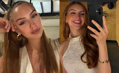 ¿De qué murió Lucia Sisic, Miss Austria, a los 22 años? Esto se sabe de su salud y sus 7 cirugías de corazón