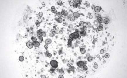 Nuevo logro científico: Investigadores consiguen que células artificiales produzcan lagrimas