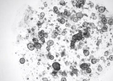 Nuevo logro científico: Investigadores consiguen que células artificiales produzcan lagrimas