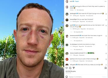 Mark Zuckerberg aparece con moretones en la cara: "el combate se salió un poco de control"