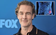 James Van Der Beek: ¿qué es el cáncer colorrectal, la enfermedad que padecía el actor?; conoce sus principales síntomas