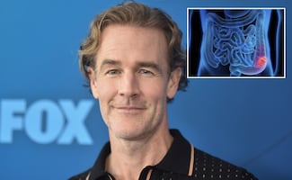 James Van Der Beek: ¿qué es el cáncer colorrectal, la enfermedad que padecía el actor?; conoce sus principales síntomas