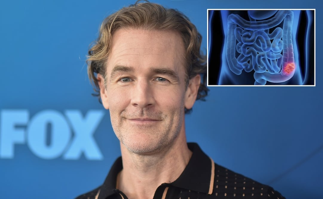 El nombre de James Van Der Beek marcó a toda una generación que creció con los dramas juveniles de finales de los 90. (Photo by Richard Shotwell/Invision/AP, File)