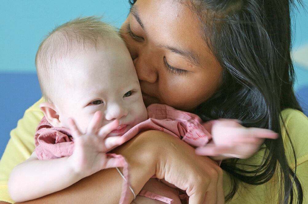 Pattaramon Chanbua besa a Gammy. Una pareja gay de Australia dejó al niño, que la mujer tuvo para ellos, porque nació con síndrome de Down (APICHART WEERAWONG. AP)
