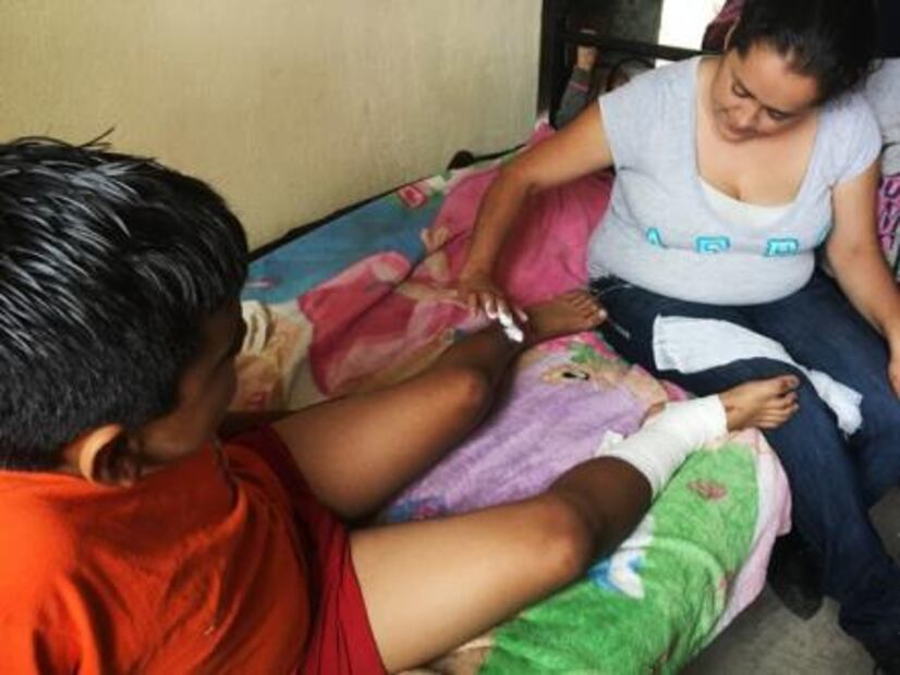 Niño sufre quemaduras por falla geotérmica en Michoacán