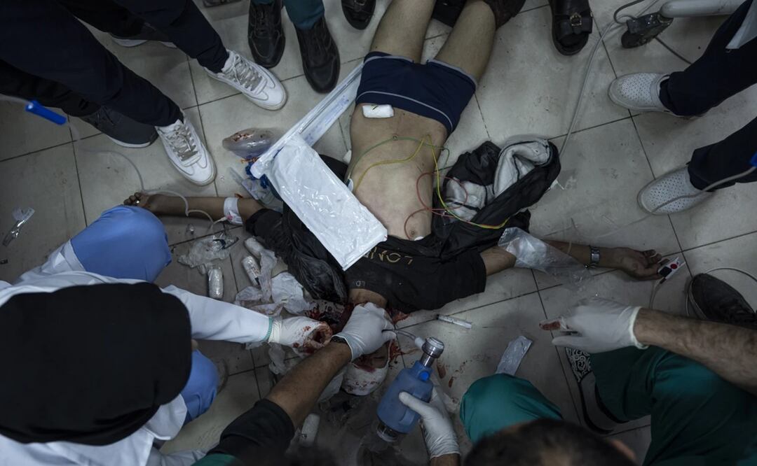 Palestinos heridos en el bombardeo israelí en la Franja de Gaza son trasladados al hospital Al Najjar de Rafah, en la Franja de Gaza. Foto: AP