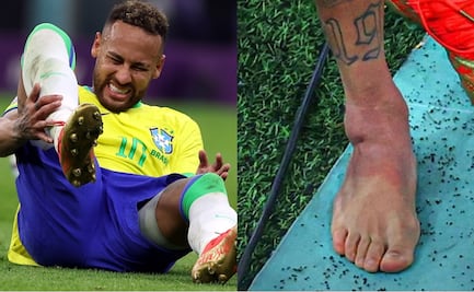Alarmas en Brasil por lesión de Neymar; así terminó su pie