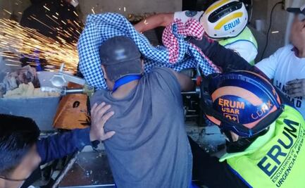 Máquina de tortillas prensa mano de joven de 17 años en la Cuauhtémoc; es auxiliado por bomberos y paramédicos 
