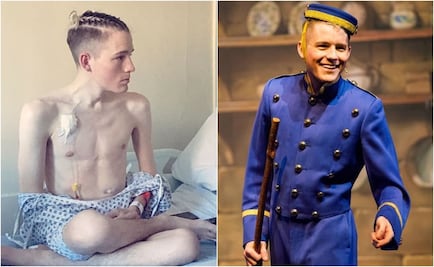 Trasplante de órganos. El actor que recibió dos pulmones y se convirtió en estelar de obras musicales