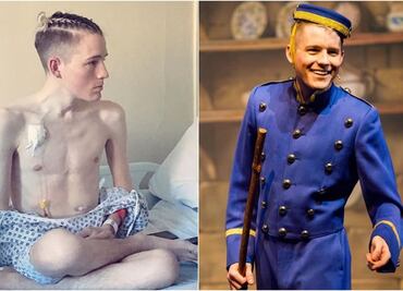 Trasplante de órganos. El actor que recibió dos pulmones y se convirtió en estelar de obras musicales