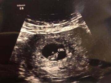 Viuda de Purón Johnston revela que está embarazada