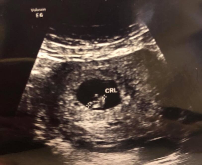 Foto del ultrasonido compartida por Cynthia Villarreal (Foto: tomada de Facebook)