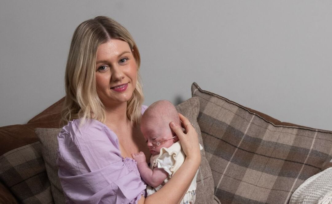 Elsie Dutton con su mamá Amy. Foto: MERCURY PRESS