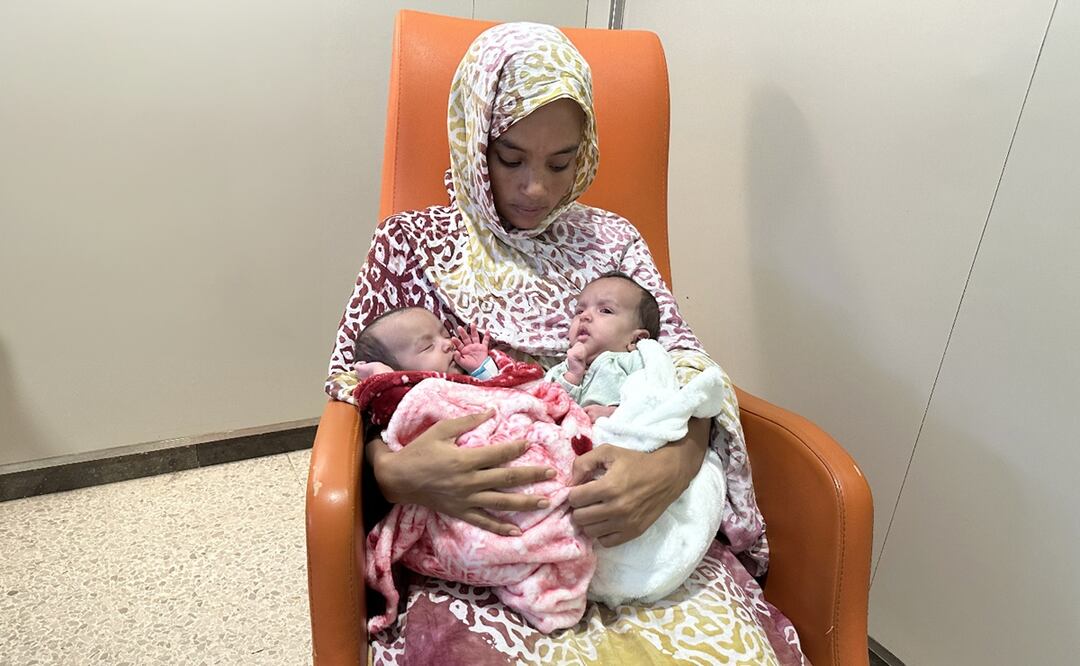 Khadija y Cherive, las dos bebés siamesas procedentes de Mauritania que estaban unidas por el abdomen, se recuperan en el Hospital Sant Joan de Déu tras haber sido separadas con éxito en una operación compleja. Foto: EFE
