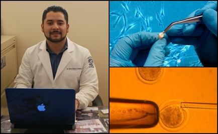 Mexican scientists develop stem cell bank from dental pieces
