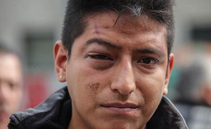 INBA presenta denuncia por agresión en Bellas Artes