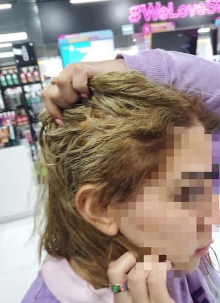 Decoloración fallida: quemaron su pelo y su denuncia se hizo viral