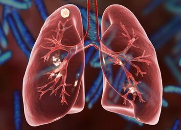 Descubren el mecanismo que hace a la tuberculosis tan virulenta