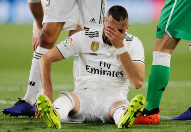 Karim Benzema se fractura en el duelo frente al Betis