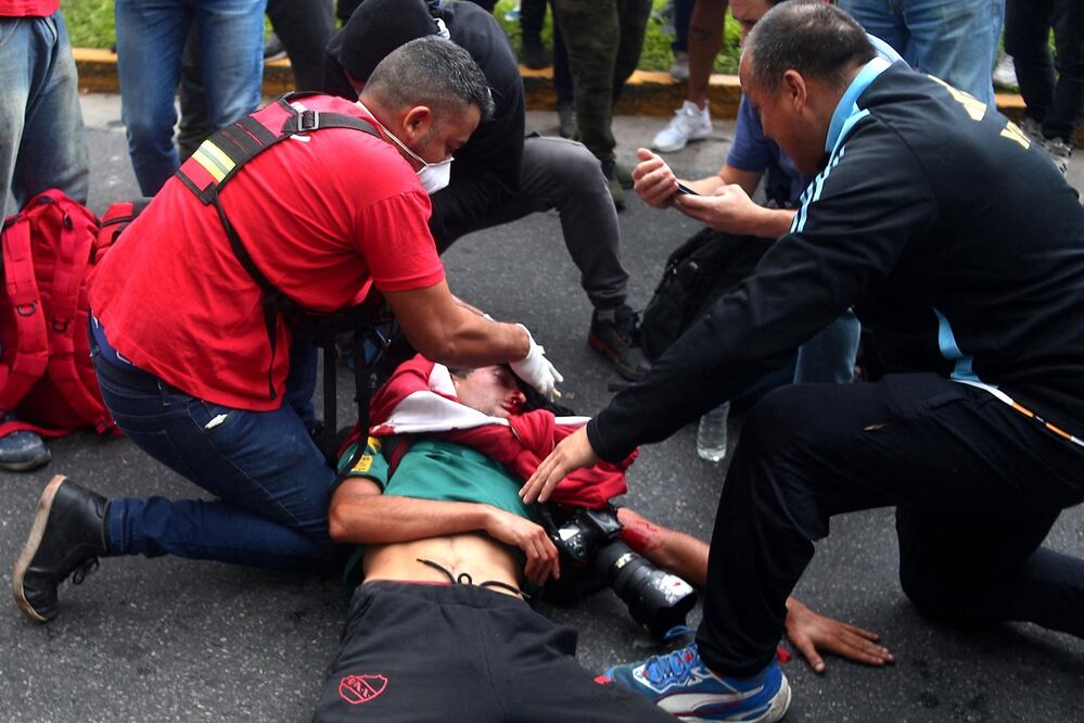 El fotoperiodista argentino Pablo Grillo recibe atención médica tras resultar herido durante una protesta de jubilados, apoyada por aficionados al futbol, ​​contra el gobierno del presidente Javier Milei en Buenos Aires. Foto: AFP