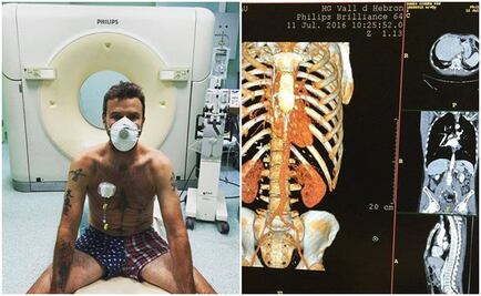 Vocalista de Jarabe de Palo, limpio de cáncer