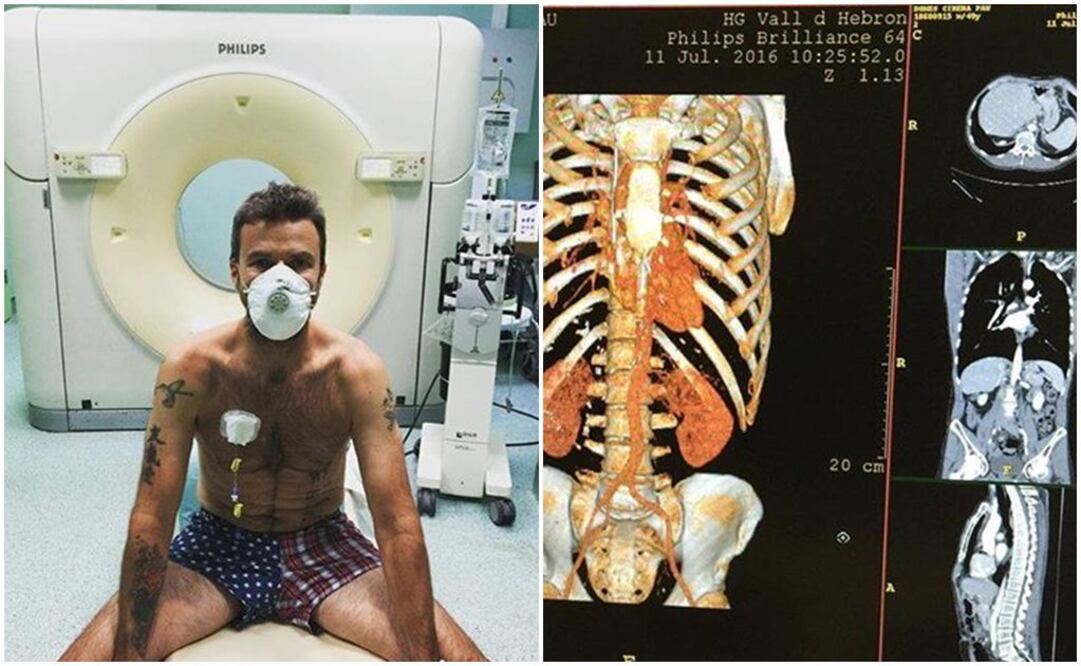 FOTO: Facebook Jarabe de Palo