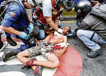 Muere joven de 17 años en las protestas en Venezuela